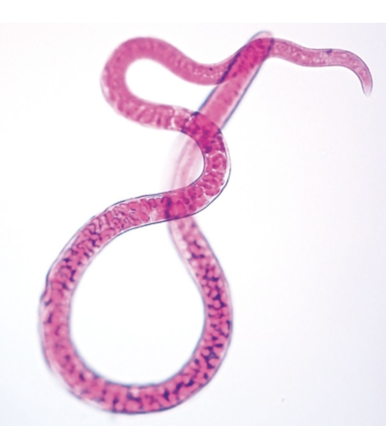 Trichinella espiralis Hembra,Lámina de Microscopio