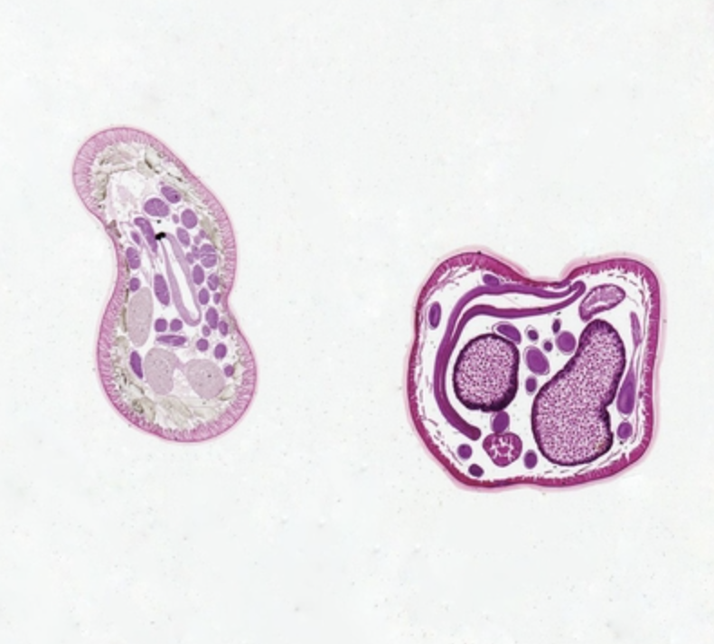 Làmina para microscopio, Ascaris lumbricoides Macho y Hembra