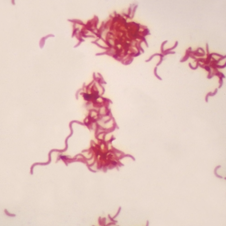 Spirillum gramnegativo, pieza completa Portaobjetos de microscopio para tinción de Gram negativa