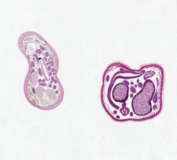 [306918] Làmina para microscopio, Ascaris lumbricoides Macho y Hembra